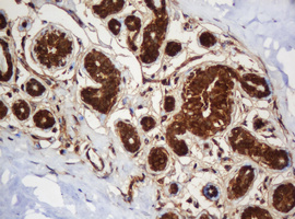 IHC of paraffin-embedded Human breast tissue using anti-SERBP1 mouse monoclonal antibody.