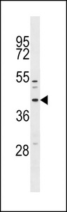 MFF Antibody western blot of NCI-H460 cell line lysates (35 ug/lane). The MFF antibody detected the MFF protein (arrow).