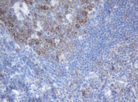 IHC of paraffin-embedded Human lymph node tissue using anti-SERBP1 mouse monoclonal antibody.