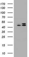 HEK293T cells were transfected with the pCMV6-ENTRY control (Left lane) or pCMV6-ENTRY SERBP1 (Right lane) cDNA for 48 hrs and lysed. Equivalent amounts of cell lysates (5 ug per lane) were separated by SDS-PAGE and immunoblotted with anti-SERBP1.