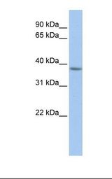 Fetal muscle lysate. Antibody concentration: 1.0 ug/ml. Gel concentration: 12%.