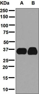 Western blot analysis on (A) fetal muscle and (B) fetal heart lysates using anti-MFF antibody.
