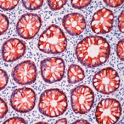 Formalin-fixed, paraffin-embedded human colon stained with peroxidase-conjugate and AEC chromogen. Note cytoplasmic staining of epithelial cells.