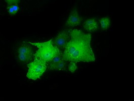 Anti-PAICS mouse monoclonal antibody immunofluorescent staining of COS7 cells transiently transfected by pCMV6-ENTRY PAICS.