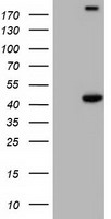 HEK293T cells were transfected with the pCMV6-ENTRY control (Left lane) or pCMV6-ENTRY PAICS (Right lane) cDNA for 48 hrs and lysed. Equivalent amounts of cell lysates (5 ug per lane) were separated by SDS-PAGE and immunoblotted with anti-PAICS.
