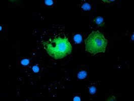 Anti-PAICS mouse monoclonal antibody immunofluorescent staining of COS7 cells transiently transfected by pCMV6-ENTRY PAICS.