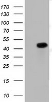 HEK293T cells were transfected with the pCMV6-ENTRY control (Left lane) or pCMV6-ENTRY PAICS (Right lane) cDNA for 48 hrs and lysed. Equivalent amounts of cell lysates (5 ug per lane) were separated by SDS-PAGE and immunoblotted with anti-PAICS.