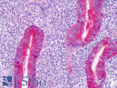 Anti-PAICS / ADE2 antibody IHC staining of human uterus, endometrium. Immunohistochemistry of formalin-fixed, paraffin-embedded tissue after heat-induced antigen retrieval.
