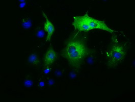 Anti-PAICS mouse monoclonal antibody immunofluorescent staining of COS7 cells transiently transfected by pCMV6-ENTRY PAICS.