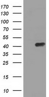HEK293T cells were transfected with the pCMV6-ENTRY control (Left lane) or pCMV6-ENTRY PAICS (Right lane) cDNA for 48 hrs and lysed. Equivalent amounts of cell lysates (5 ug per lane) were separated by SDS-PAGE and immunoblotted with anti-PAICS.