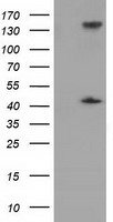 HEK293T cells were transfected with the pCMV6-ENTRY control (Left lane) or pCMV6-ENTRY PAICS (Right lane) cDNA for 48 hrs and lysed. Equivalent amounts of cell lysates (5 ug per lane) were separated by SDS-PAGE and immunoblotted with anti-PAICS.