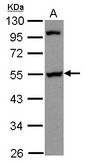 Sample (30 ug of whole cell lysate) A: A431 10% SDS PAGE PAIP1 antibody diluted at 1:1000