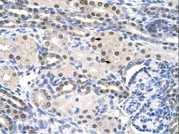 PAIP1 antibody LS-C31607 was used in IHC to stain formalin-fixed, paraffin-embedded human kidney.