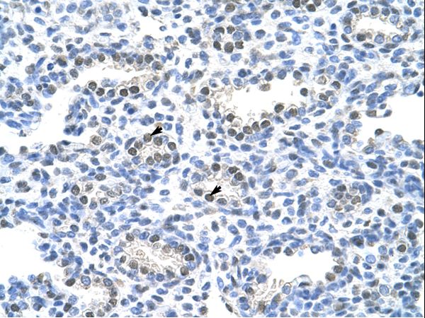 PAIP1 antibody LS-C31607 was used in IHC to stain formalin-fixed, paraffin-embedded human lung.