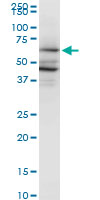 PAIP1 monoclonal antibody (M04), clone 2D11. Western blot of PAIP1 expression in HeLa.