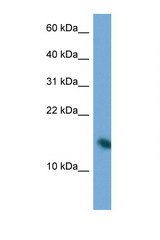 PAIP2 antibody LS-C145234 Western blot of Jurkat Cell lysate. Antibody concentration 1 ug/ml.