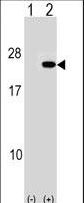 Western blot of PAIP2 (arrow) using rabbit polyclonal PAIP2 Antibody. 293 cell lysates (2 ug/lane) either nontransfected (Lane 1) or transiently transfected (Lane 2) with the PAIP2 gene.