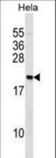 PAIP2 Antibody western blot of HeLa cell line lysates (35 ug/lane). The PAIP2 antibody detected the PAIP2 protein (arrow).