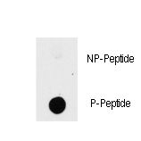 Dot blot of anti-PAK1-pT423 Phospho-specific antibody on nitrocellulose membrane. 50ng of Phospho-peptide or Non Phospho-peptide per dot were adsorbed. Antibody working concentrations are 0.5ug per ml.