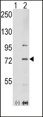 Western blot of PAK1 (arrow) using rabbit polyclonal PAK1 Antibody (T423). 293 cell lysates (2 ug/lane) either nontransfected (Lane 1) or transiently transfected with the PAK1 gene (Lane 2) (Origene Technologies).