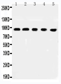 WB of MCC antibody. All lanes: Anti-MCC at 0.5ug/ml. Lane 1: Rat Brain Tissue Lysate at 40ug. Lane 2: 293T Whole Cell Lysate at 40ug. Lane 3: NIH Whole Cell Lysate at 40ug. Lane 4: A549 Whole Cell Lysate at 40ug. Lane 5: HEPG2 Whole Cell Lysate at 40ug. Predicted bind size: 93KD. Observed bind size: 93KD.