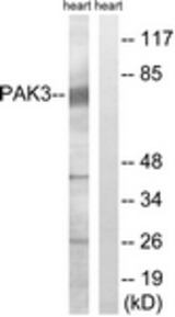 Western blot of extracts from rat heart cells, using PAK3 (Ab-154) Antibody. The lane on the right is treated with the synthesized peptide.