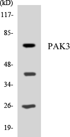 Western blot of the lysates from HeLa cells using PAK3 antibody.