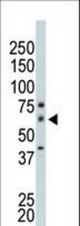 The anti-PAK4 antibody is used in Western blot to detect PAK4 in mouse small intestine tissue lysate.
