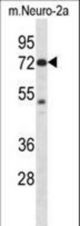 Mouse Pak4 Antibody western blot of Neuro-2a cell line lysates (35 ug/lane). The Pak4 antibody detected the Pak4 protein (arrow).
