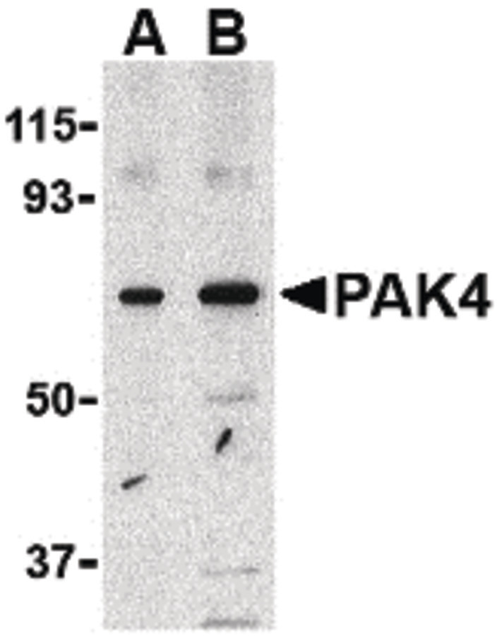 Western blot of PAK4 in SW480 lysate with PAK4 antibody at (A) 1 and (B) 2 ug/ml.