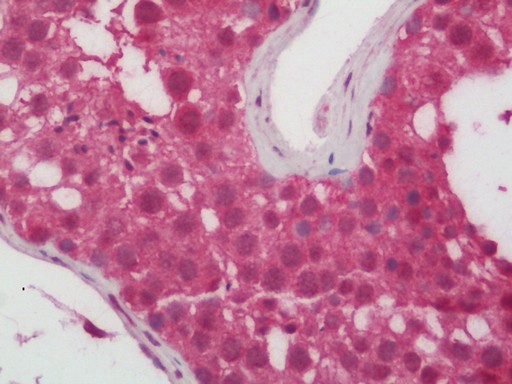 Human Testis: Formalin-Fixed, Paraffin-Embedded (FFPE)