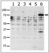 Western blot of anti-PAK6 antibody in lysates from transiently transfected COS7 cells. Lane 1: negative control, Lane 2: PAK1-expressing cells, Lane 3: PAK2-expressing cells, Lane 4: PAK4-expressing cells, Lane 5: PAK5-expressing cells, and Lane 6: PAK6-expressing cells. PAK6 (arrow) was detected using purified antibody. Data is kindly provided by Drs. Z.M. Jaffer and J. Chernoff from the Fox Chase Cancer Center (Philadelphia, PA).