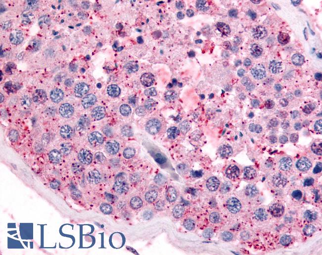Anti-PAK6 antibody LS-A6949 IHC of human testis. Immunohistochemistry of formalin-fixed, paraffin-embedded tissue after heat-induced antigen retrieval.