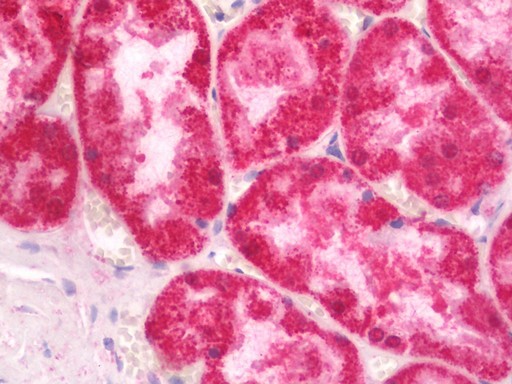 Human Kidney: Formalin-Fixed, Paraffin-Embedded (FFPE)