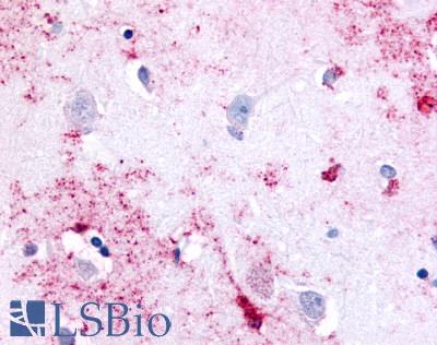 Anti-PAK6 antibody LS-A6942 IHC of human brain, neurons and glia. Immunohistochemistry of formalin-fixed, paraffin-embedded tissue after heat-induced antigen retrieval.