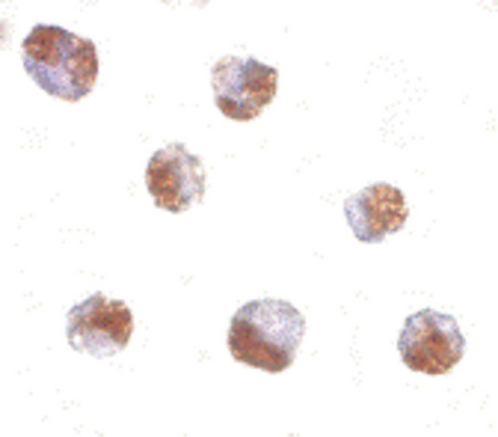 Immunocytochemistry of PAK6 in Raji cells with PAK6 antibody at 10 ug/ml.