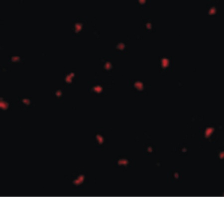 Immunofluorescence of PAK6 in Raji cells with PAK6 antibody at 10 ug/ml.