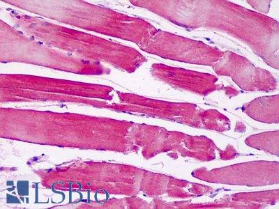 Anti-PAK6 antibody IHC staining of human skeletal muscle. Immunohistochemistry of formalin-fixed, paraffin-embedded tissue after heat-induced antigen retrieval.