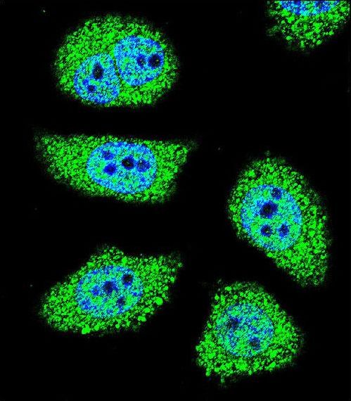 Confocal immunofluorescent of PAK6 Antibody with U-251MG cell followed by Alexa Fluor 488-conjugated goat anti-rabbit lgG (green). DAPI was used to stain the cell nuclear (blue).