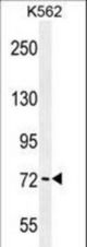 PAK6 Antibody western blot of K562 cell line lysates (35 ug/lane). The PAK6 antibody detected the PAK6 protein (arrow).