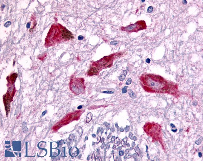 Anti-PAK7 antibody IHC of human brain, substantia nigra neurons. Immunohistochemistry of formalin-fixed, paraffin-embedded tissue after heat-induced antigen retrieval.