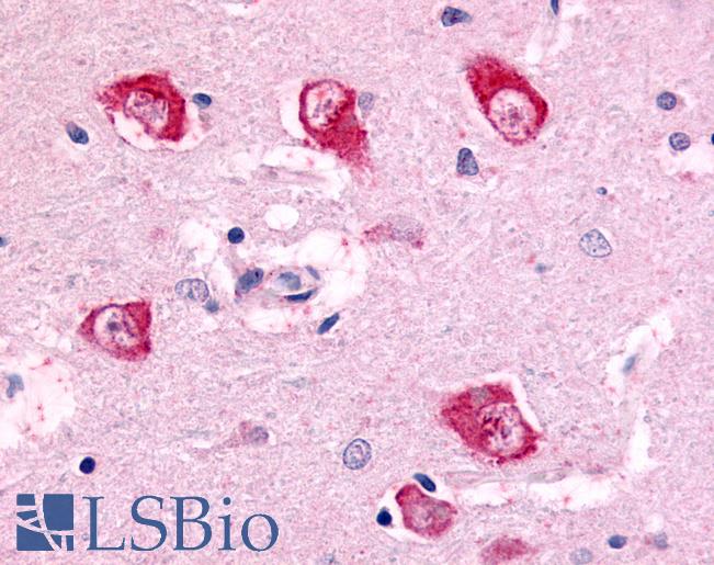Anti-PAK7 antibody IHC of human brain, thalamus neurons. Immunohistochemistry of formalin-fixed, paraffin-embedded tissue after heat-induced antigen retrieval.