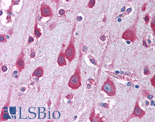 Anti-PAK7 antibody IHC of human brain, cortex. Immunohistochemistry of formalin-fixed, paraffin-embedded tissue after heat-induced antigen retrieval. Antibody LS-B1385 concentration 5 ug/ml.