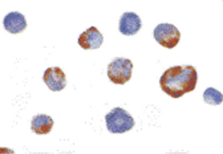 Immunocytochemistry of PAK5 in K562 cells with PAK5 antibody at 2 ug/ml.