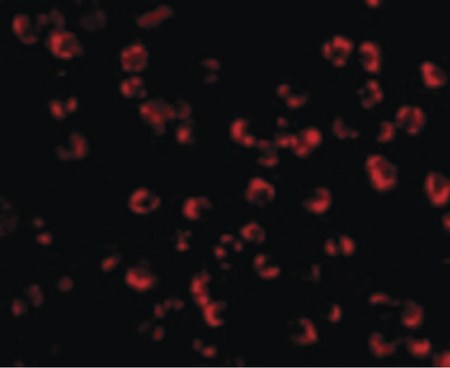 Immunofluorescence of PAK5 in K562 cells with PAK5 antibody at 10 ug/ml.