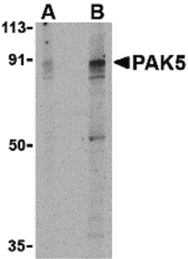 Western blot of PAK5 in T24 lysate with PAK5 antibody at (A) 2 and (B) 4 ug/ml.