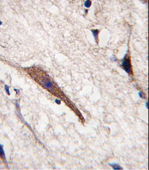 Formalin-fixed and paraffin-embedded human brain tissue reacted with PAK5 antibody, which was peroxidase-conjugated to the secondary antibody, followed by DAB staining. This data demonstrates the use of this antibody for immunohistochemistry; clinical relevance has not been evaluated.