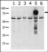 Western blot of anti-PAK5 antibody in lysates from transiently transfected COS7 cells. Lane 1: negative control, Lane 2: PAK1-expressing cells, Lane 3: PAK2-expressing cells, Lane 4: PAK4-expressing cells, Lane 5: PAK5-expressing cells, and Lane 6: PAK6-expressing cells. PAK5 (arrow) was detected using purified antibody. Data is kindly provided by Drs. Z.M. Jaffer and J. Chernoff from the Fox Chase Cancer Center (Philadelphia, PA).