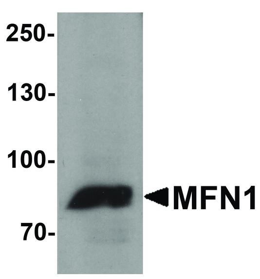 Western blot analysis of MFN1 in A431 cell lysate with MFN1 antibody at 1 ug/ml.