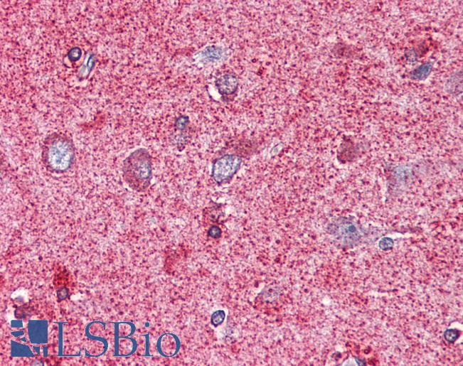 Anti-PAK7 antibody LS-A7308 IHC of human brain, cortex. Immunohistochemistry of formalin-fixed, paraffin-embedded tissue after heat-induced antigen retrieval.